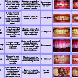 All Dental.treatments